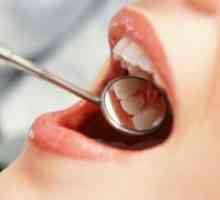 Gum Disease - Tratamentul