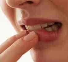 Inflamarea gingiei din jurul dintelui