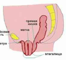 Prolaps uterin - Simptome