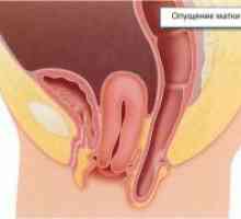 Prolaps de col uterin