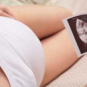 18 De săptămâni de sarcină - nu perturbațiilor