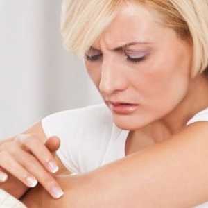Dermatita atopică - simptome și tratament la adulți