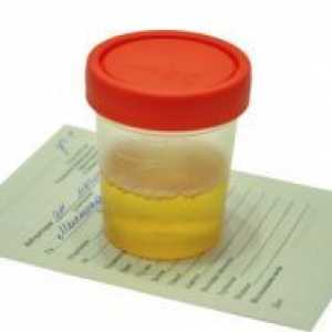 Analiza urinei - norma la copii
