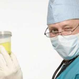 Analiza urinei la copii - decodare, masa