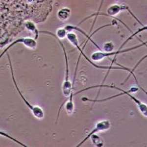 Analiza spermei