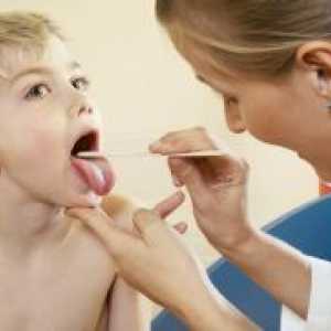 Antibiotice pentru dureri în gât la copii