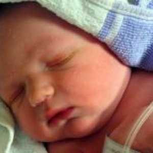 Atrezie esofagian nou-născut