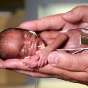 Sarcina 28 săptămâni - dezvoltării fetale