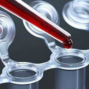 Ce face un test de sânge CEA?