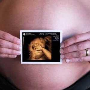 Ce este o ecografie 3D in timpul sarcinii