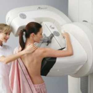 Mamografie digitala