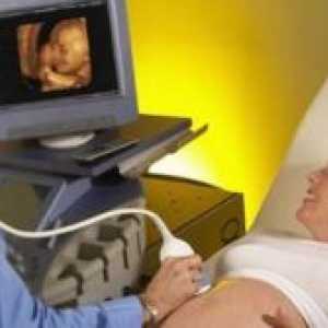 Doppler în timpul sarcinii - transcriere