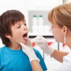 Faringita la copii - Tratamentul