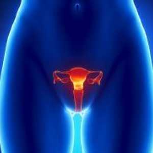 Fibrom uterin - Simptome