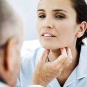 Hipertiroidismul - Tratamentul