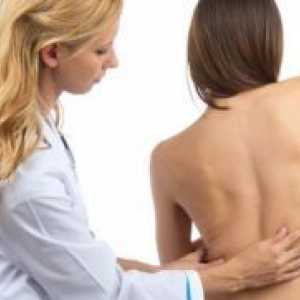 Coloanei vertebrale lombare hernie - Simptome