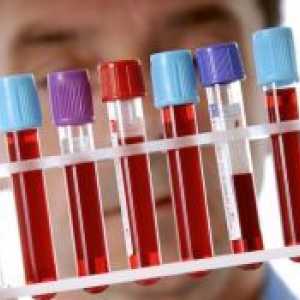 Test de sânge imunoenzimatică