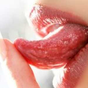 Ulcerele pe limbă
