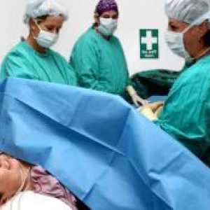 O operație cezariană de urgență