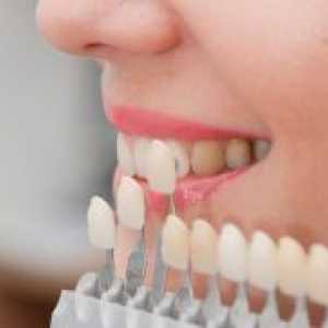 Restaurare estetică dentară