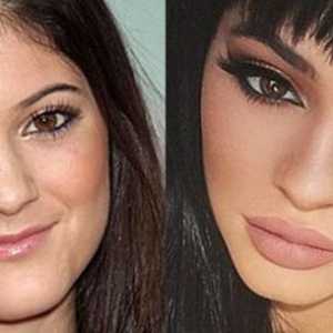 Kylie Jenner înainte și după plastic