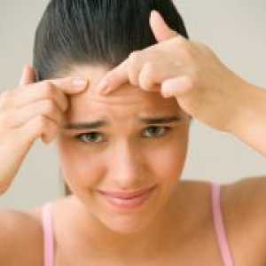 Cum să scapi de acnee pe fata ta un adolescent?