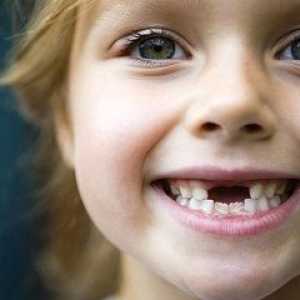 Cum de a schimba dintii la copii