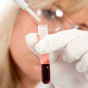 Cum de a determina grupa de sânge grupa de sânge copilului de părinți?