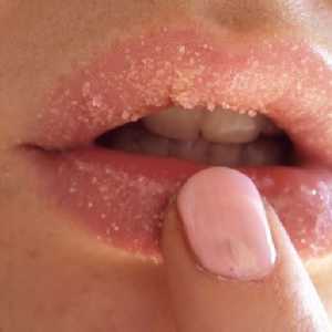 Cum de a vindeca buzele crapate?