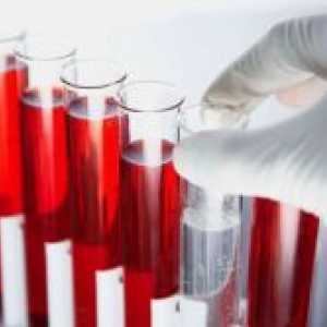 Când donează sânge pe HCG?