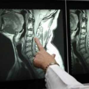 Tomografia computerizată a coloanei vertebrale