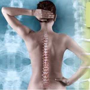 Tratamentul protruziei a coloanei vertebrale lombare