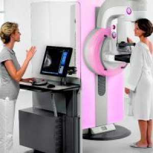 Mamografie - când să facă?