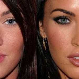 Megan Fox, înainte și după plastic