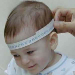 Microcefalie la copii