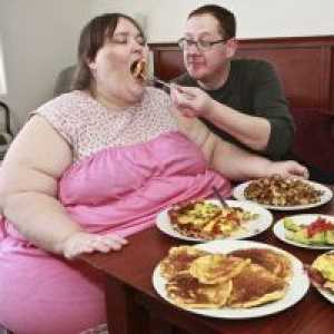 Obezitate morbida