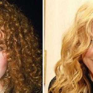 Nicole Kidman - atât înainte, cât și după plastic