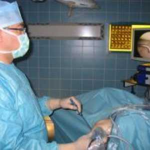 Chirurgie pe meniscul genunchiului