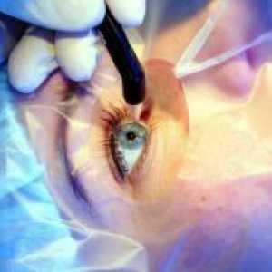 Ochi chirurgie corectivă
