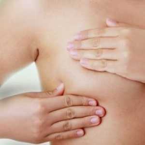 Tumori de sân la femei - Simptome