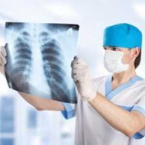 Edemul pulmonar - Simptome