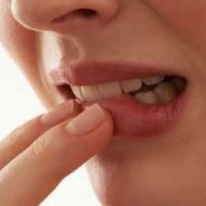 Parodontita - tratament