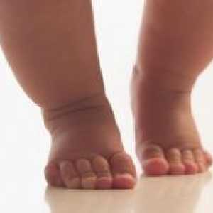 De ce copilul merge în vârful picioarelor în 8 luni?