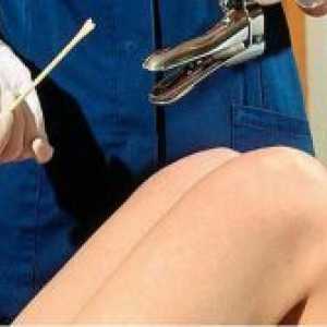 Însămânțarea canalului cervical