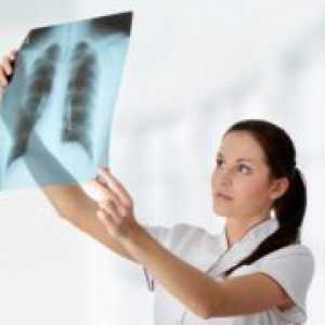 Prevenirea tuberculozei