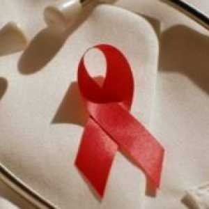 Infecția cu HIV Prevenirea