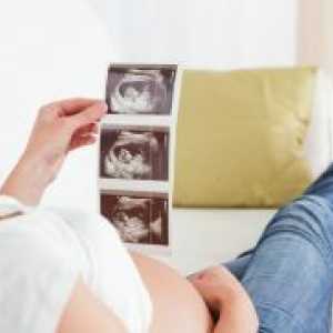 Proginova în timpul sarcinii