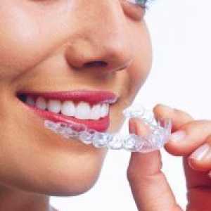Mouthguard transparent la alinierea dinților