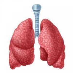 Sarcoidoza pulmonară - tratament