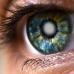 Simptomele de cataractă în stadiile incipiente